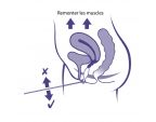 Schéma d'utilisation de la sonde de rééducation périnéale Periform +