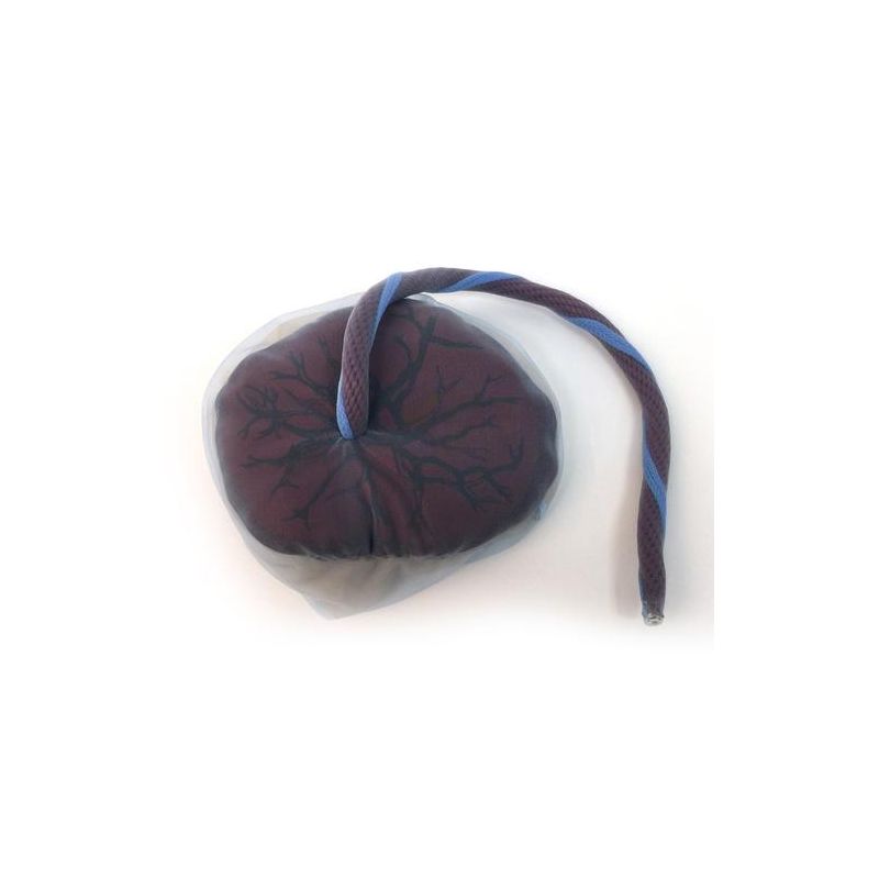 PLACENTA ET CORDON OMBILICAL