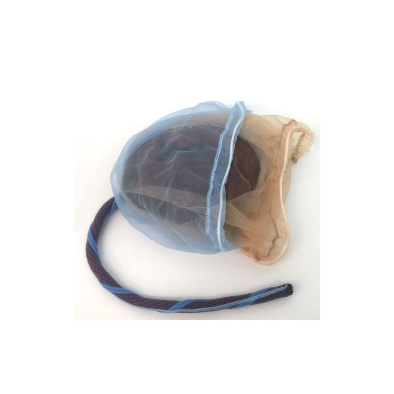 PLACENTA ET CORDON OMBILICAL