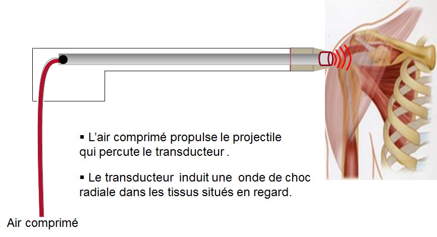 Propagation d'une onde de choc radiale